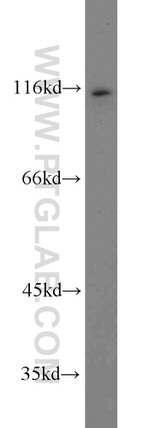 FOXM1 Antibody in Western Blot (WB)