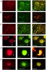 Synapsin 1 Antibody in Immunocytochemistry (ICC/IF)