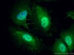 UGDH Antibody in Immunocytochemistry (ICC/IF)