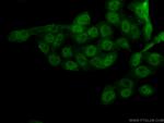 SIRT1 Antibody in Immunocytochemistry (ICC/IF)