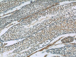 SIRT1 Antibody in Immunohistochemistry (Paraffin) (IHC (P))