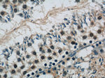 SIRT1 Antibody in Immunohistochemistry (Paraffin) (IHC (P))