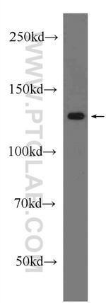 SIRT1 Antibody in Western Blot (WB)