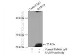 RAB39 Antibody in Immunoprecipitation (IP)