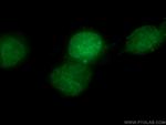 PARP1 Antibody in Immunocytochemistry (ICC/IF)