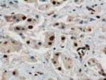 PARP1 Antibody in Immunohistochemistry (Paraffin) (IHC (P))