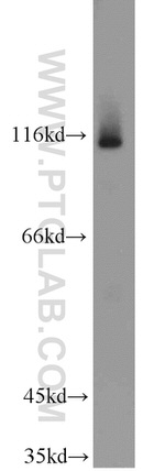 PARP1 Antibody in Western Blot (WB)