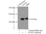 SNX19 Antibody in Immunoprecipitation (IP)