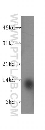 ACYP1 Antibody in Western Blot (WB)