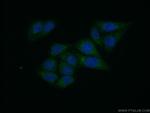 GPD1 Antibody in Immunocytochemistry (ICC/IF)