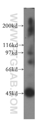 ACTL7B Antibody in Western Blot (WB)