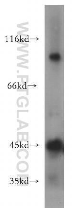 ACTL7B Antibody in Western Blot (WB)