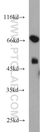 TXNDC3 Antibody in Western Blot (WB)