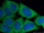 GZMB Antibody in Immunocytochemistry (ICC/IF)