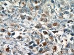 GZMB Antibody in Immunohistochemistry (Paraffin) (IHC (P))