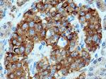 SEC24D Antibody in Immunohistochemistry (Paraffin) (IHC (P))