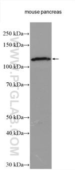 SEC24D Antibody in Western Blot (WB)