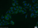 CCDC6 Antibody in Immunocytochemistry (ICC/IF)