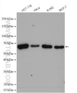 CCDC6 Antibody in Western Blot (WB)