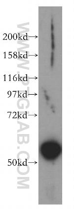 CCDC6 Antibody in Western Blot (WB)