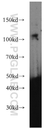 DZIP1 Antibody in Western Blot (WB)