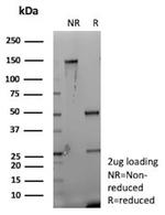 CD35/CR1 (Follicular Dendritic Cell Marker) Antibody in SDS-PAGE (SDS-PAGE)