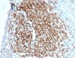 CD35/CR1 (Follicular Dendritic Cell Marker) Antibody in Immunohistochemistry (Paraffin) (IHC (P))