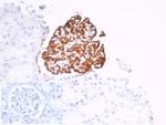 CD35/CR1 (Follicular Dendritic Cell Marker) Antibody in Immunohistochemistry (Paraffin) (IHC (P))