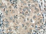 GAS6 Antibody in Immunohistochemistry (Paraffin) (IHC (P))