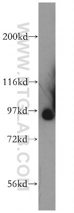 SLITRK4 Antibody in Western Blot (WB)