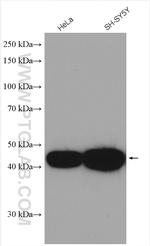 CX3CR1 Antibody in Western Blot (WB)