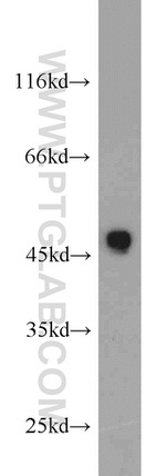 CX3CR1 Antibody in Western Blot (WB)