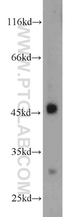 CX3CR1 Antibody in Western Blot (WB)