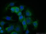 SODD/BAG4 Antibody in Immunocytochemistry (ICC/IF)