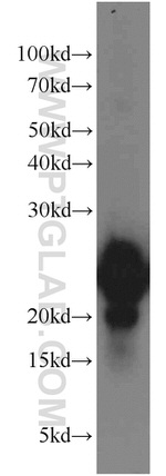 VILIP-1 Antibody in Western Blot (WB)