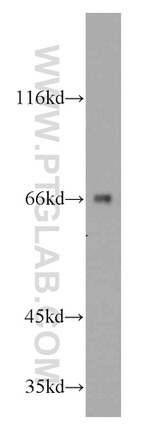 ATE1 Antibody in Western Blot (WB)