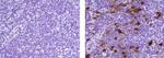 Mouse IgG2b kappa Isotype Control in Immunohistochemistry (Paraffin) (IHC (P))