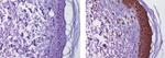 Mouse IgG2b kappa Isotype Control in Immunohistochemistry (Paraffin) (IHC (P))