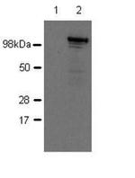 Nod2 Antibody in Western Blot (WB)