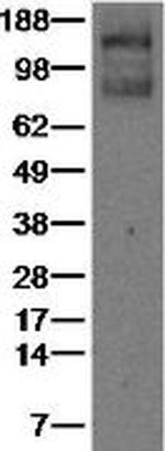 VEGF Receptor 1 (Flt1) Antibody in Western Blot (WB)