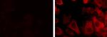 Cytokeratin 19 Antibody in Immunocytochemistry (ICC/IF)