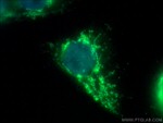 PARK2/Parkin Antibody in Immunocytochemistry (ICC/IF)