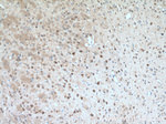 PARK2/Parkin Antibody in Immunohistochemistry (Paraffin) (IHC (P))