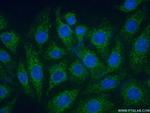 PARK2/Parkin Antibody in Immunocytochemistry (ICC/IF)