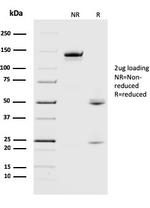 Crystallin Alpha B Antibody in SDS-PAGE (SDS-PAGE)