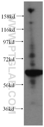 STXBP4 Antibody in Western Blot (WB)