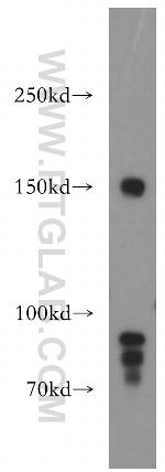 PNPLA6 Antibody in Western Blot (WB)