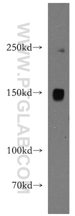 PNPLA6 Antibody in Western Blot (WB)