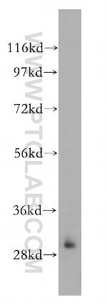 HOXC4 Antibody in Western Blot (WB)