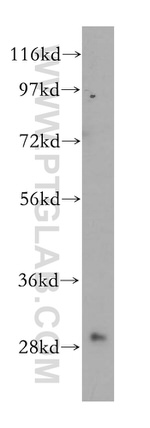 HOXC4 Antibody in Western Blot (WB)